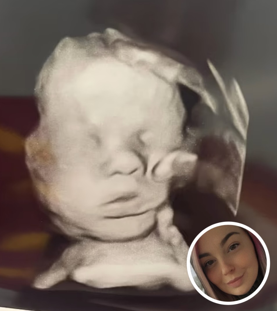 Pregnant Mom Prays For Her Baby’s Health, Stunned When She Looks Closer At Ultrasound