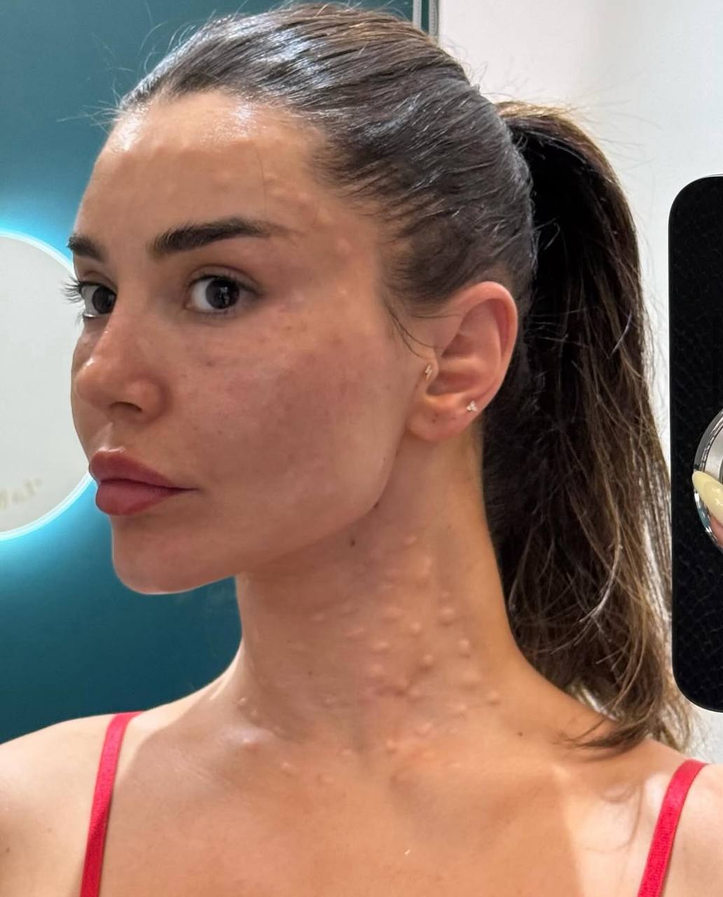 Her body was itchy, he thought it was an allergy